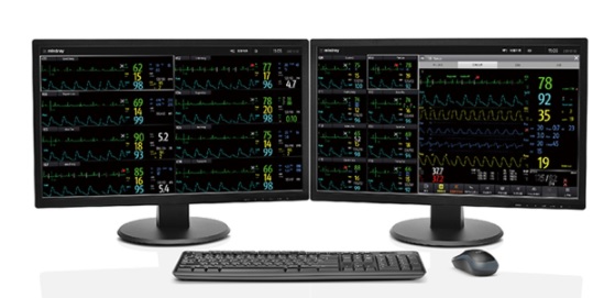Patient Monitor